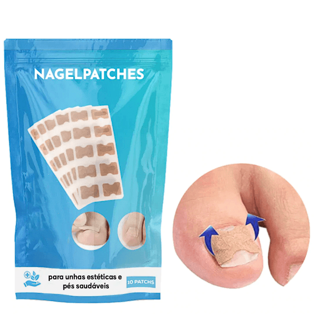 NagelPatches™ | Gesso corretivo para unhas bonitas e saudáveis