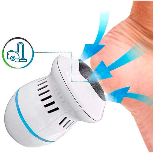 Lixador Elétrico para os Pés Removedor de Calos – FootCare™